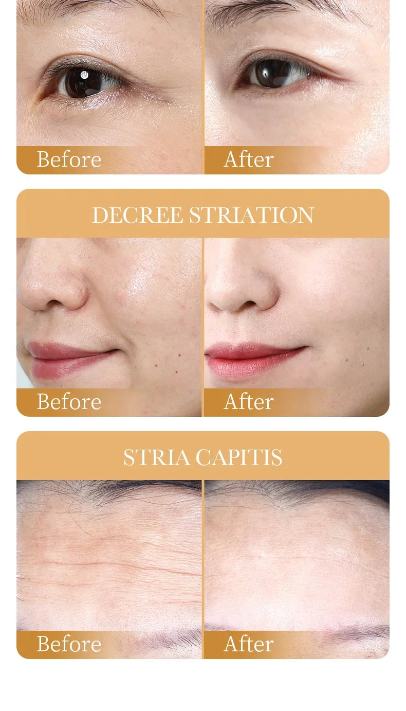 Mascarilla Facial de Colágeno Antiarrugas – Hidratante, Reafirmante y Rejuvenecedora